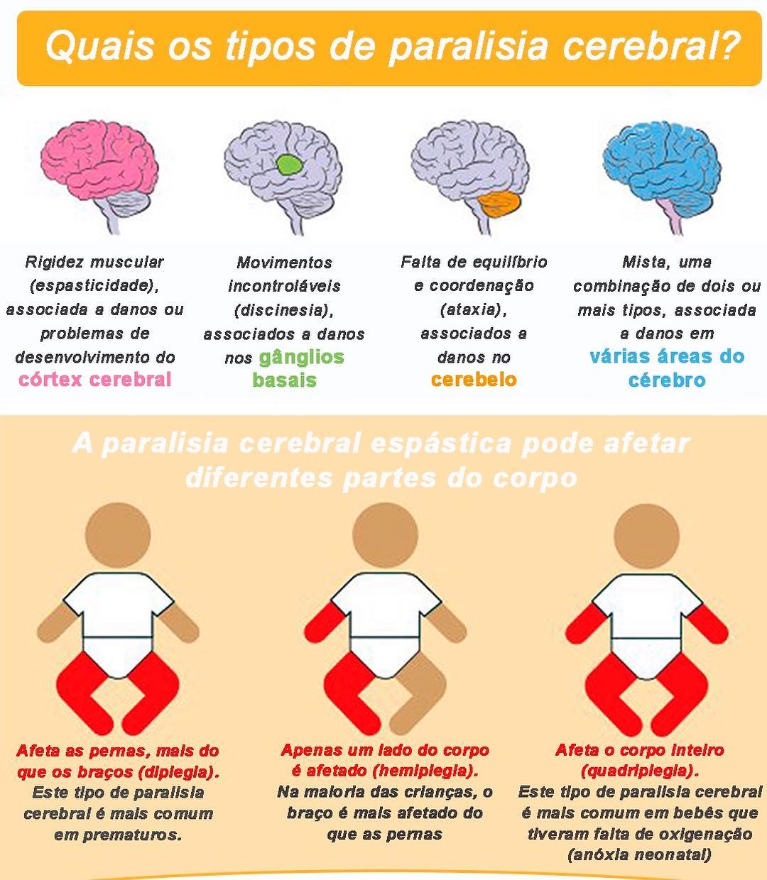 Imagem paralisiacerebral